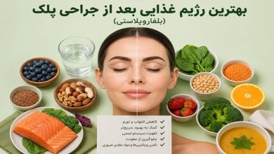 بهترین رژیم غذایی بعد از جراحی پلک (بلفاروپلاستی)