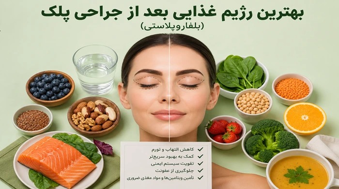 بهترین رژیم غذایی بعد از جراحی پلک (بلفاروپلاستی)